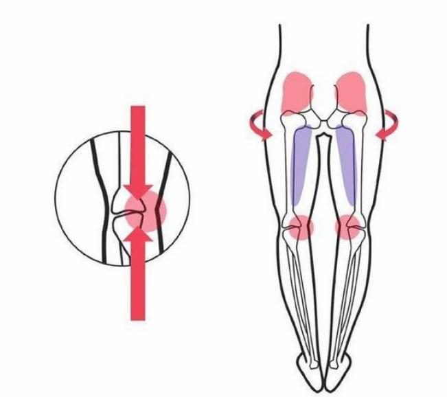 o型腿和骨关节炎有关系吗,骨关节炎怎么发展成x型腿
