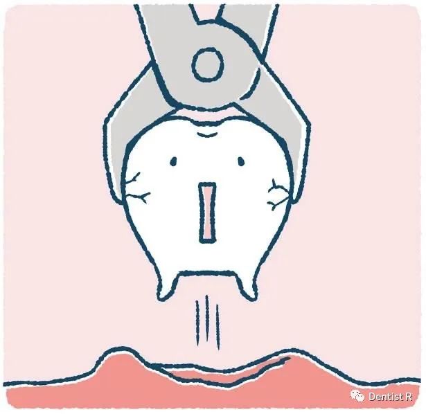 拔智齿能治脸歪吗,科普拔了智齿真的可以瘦脸吗