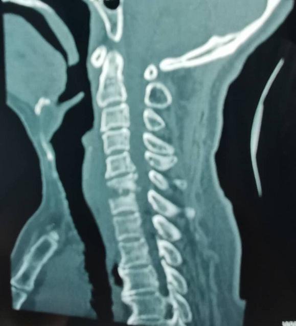 锦州市二医院骨科图片,锦州二医院颈椎手术怎么样