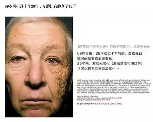女人过了45,建议出游戴帽子,既减龄还防晒,清新优雅气质撩人