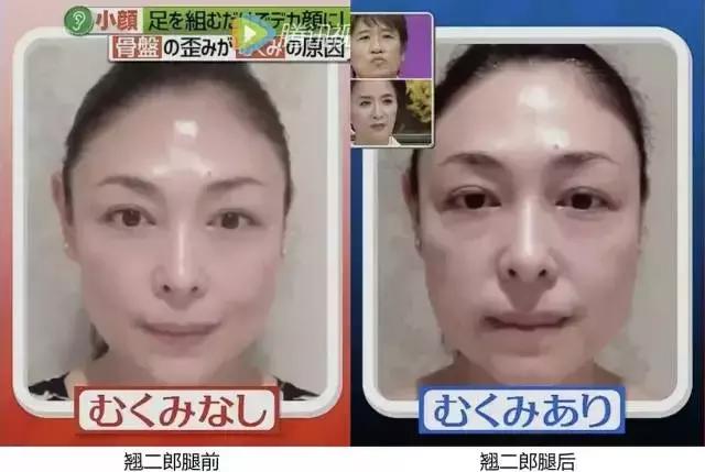 盘点让脸变大的坏习惯，你中了几个？