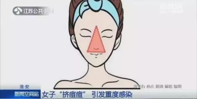 让痘印快速下去的正确方法,想要痘印好得快应该怎么办