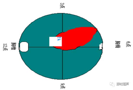 胎儿心脏三种血管关系模式图,25周的胎儿心脏弓切面多少正常