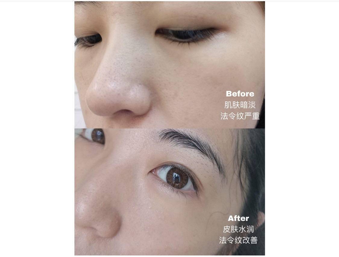 熬夜去黄提亮淡斑,熬夜祛黄吃什么