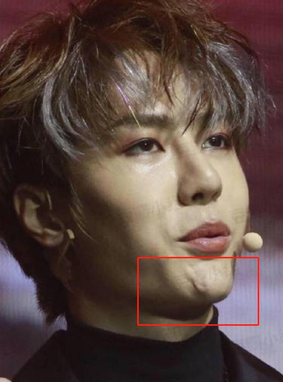 武汉协和医院王医生,武汉协和王医生