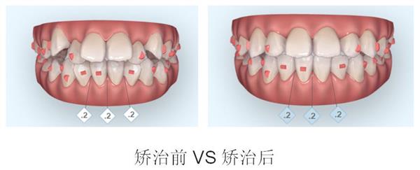 特殊儿童有效的康复治疗,无哭声医院