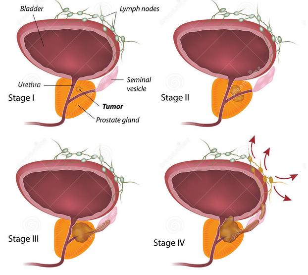 开展关爱老人健康义诊暖人心活动,前列腺义诊活动