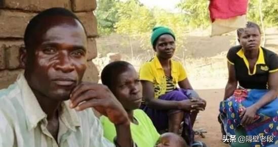 熨平少女胸部！揭秘非洲可怕习俗“烫乳”