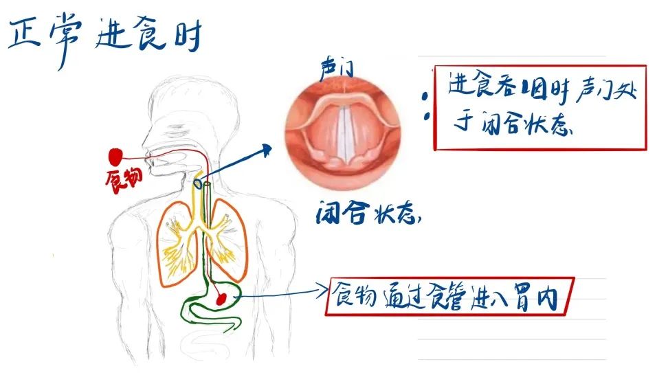 肺炎治不好会怎么样,肺炎治不好怎么办
