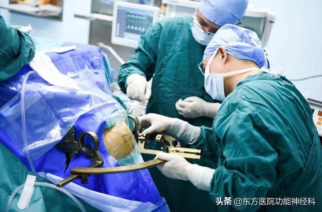 精神分裂症微创手术全过程,精神分裂症手术后的病人