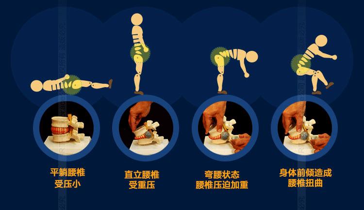 腰椎间盘突出不手术怎么治疗,腰椎间盘突出保守治疗是怎么治疗