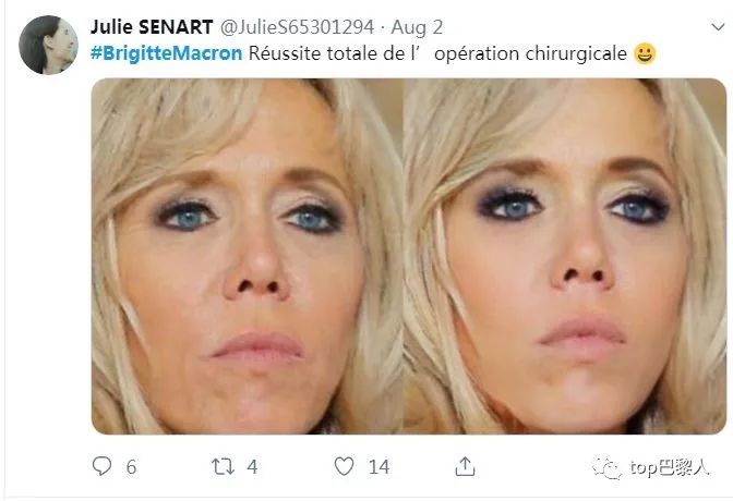 法国情侣豪掷200万，经历15次手术，只为成芭比与肯尼