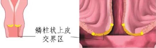 女性健康宫颈科普新闻,如何预防宫颈病变科普视频