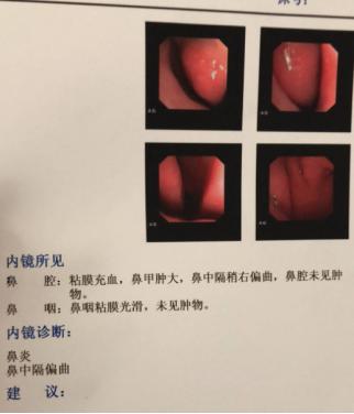 一年四季鼻炎反复发作不停怎么办,鼻炎停药就反复怎么办