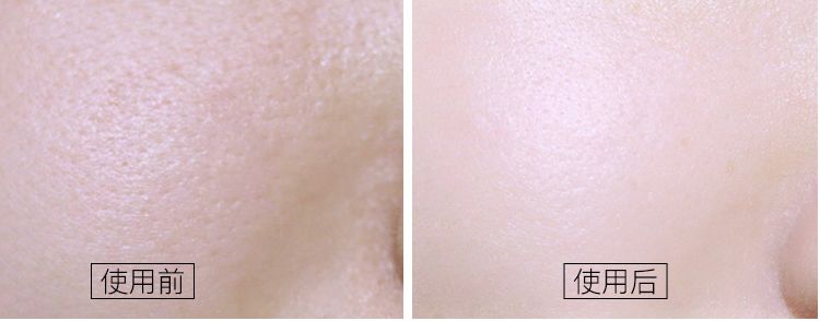 一年四季都能用的保湿面霜,皮肤干推荐一款好用的面霜