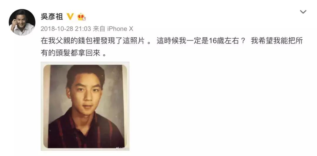 中国七成脱发人群为30岁以下,为什么年轻时不脱发到了30岁脱发