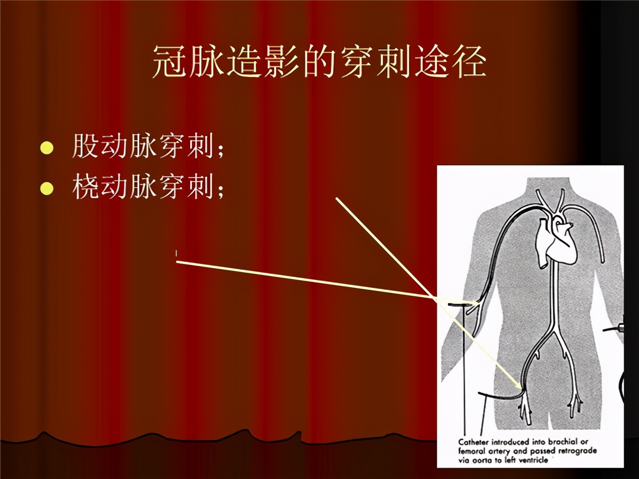 冠脉ct和冠脉造影的间隔时间多长,冠脉造影ct是怎么检查的
