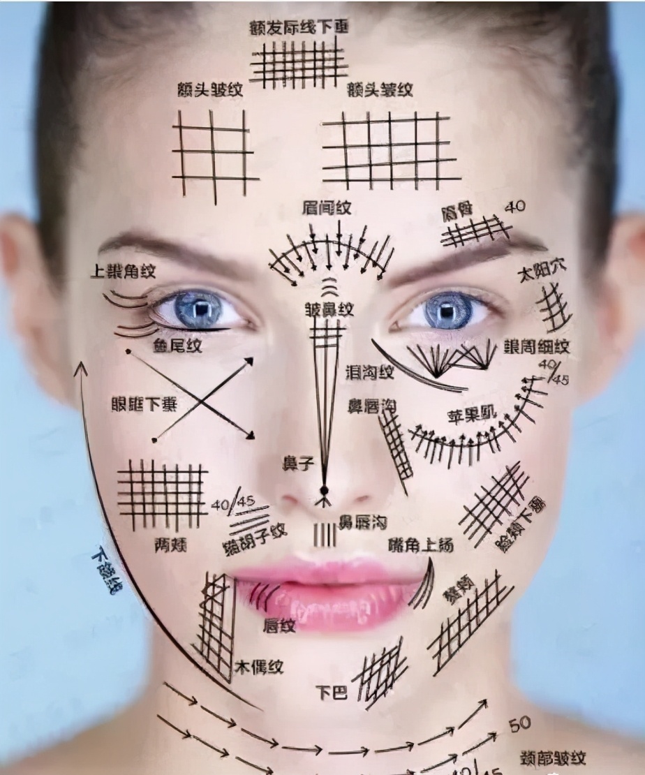 为什么线雕抗衰提拉好,丸碧抗衰线雕是什么