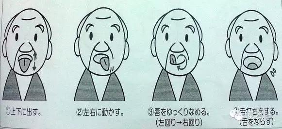 被口水呛到是脑梗前兆,脑梗引起的咽口水呛咳该怎样治疗