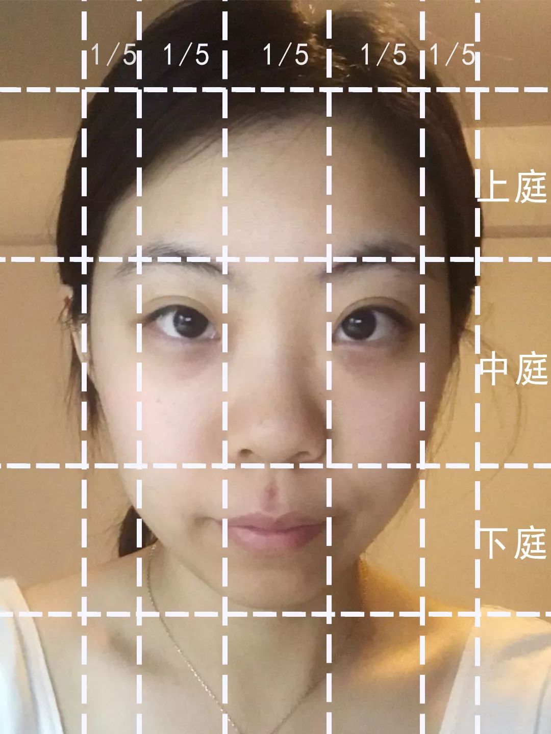 求改善痘痘真实办法,想改变脸上痘痘