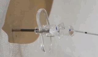 生孩子完全不疼的医院,生孩子不痛案例