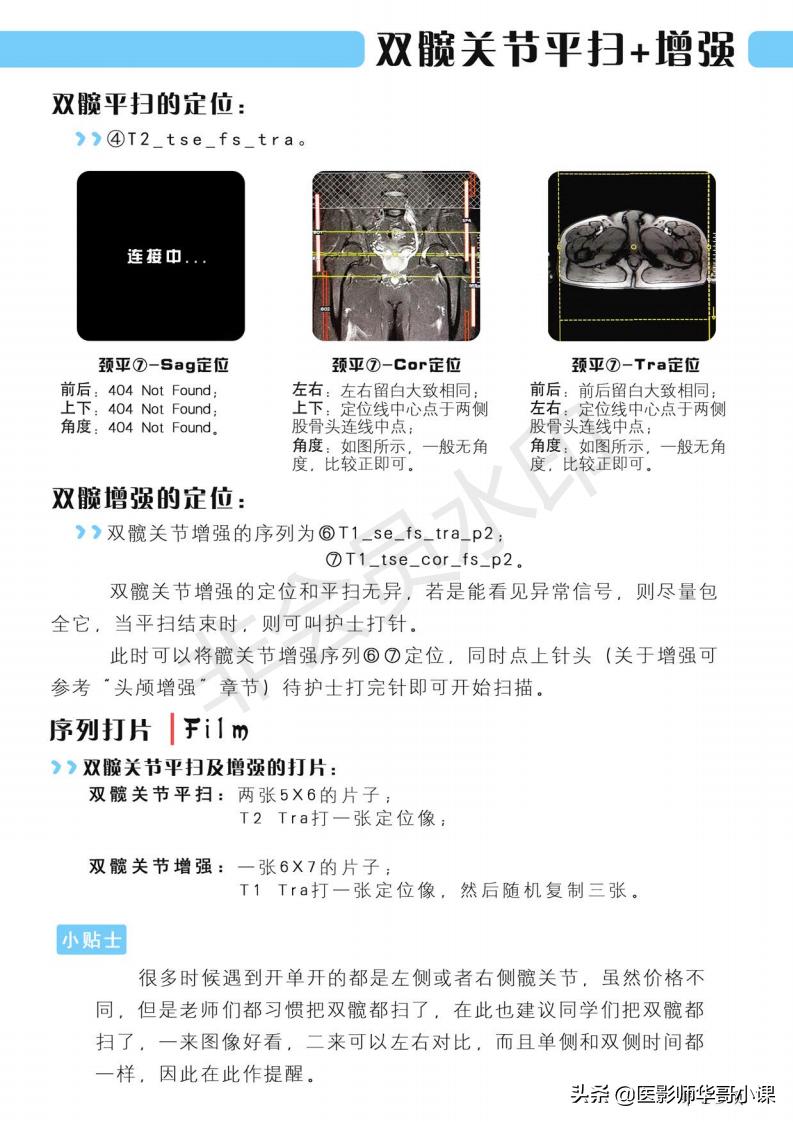 磁共振扫描技术西门子,西门子磁共振最新操作界面