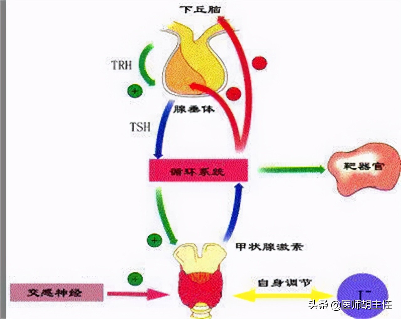 甲状腺全切是把甲状腺切除吗,甲状腺5级需要切除全部甲状腺吗