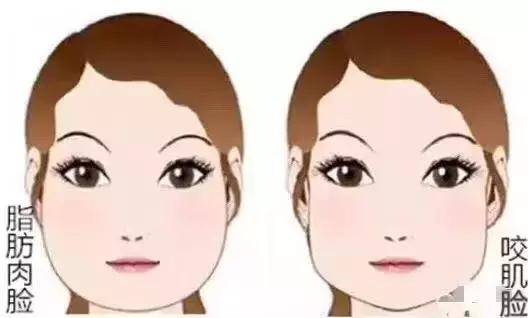 打了瘦脸针多久效果完全显现出来,打瘦脸针视频全过程