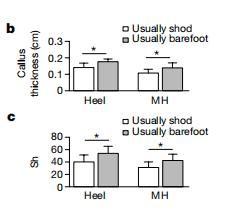 如何避免足底外侧老茧,脚上有老茧怎么样才能让脚好看
