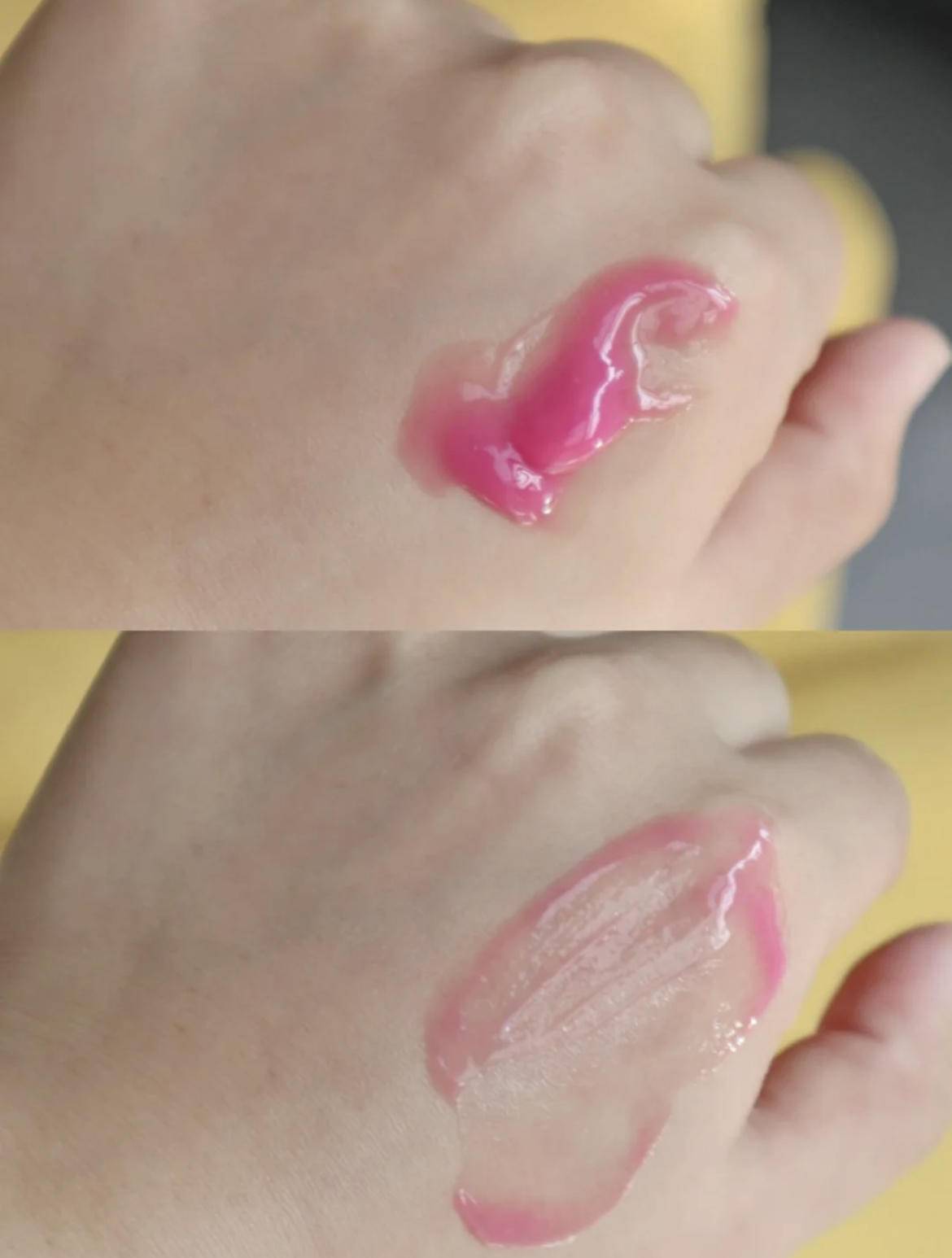 脸上有个光滑不痛不痒的小疙瘩,脸上皮肤粗糙长疙瘩是怎么回事