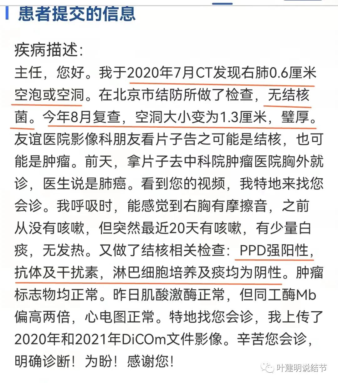 临床诊断孤立性肺结节,空洞型结节一般是什么性质