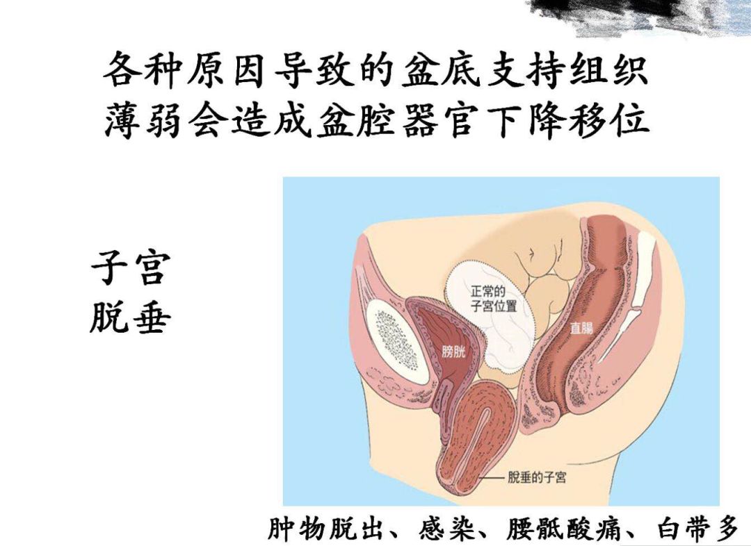 3.8产康店女神节活动方案,3.8女神节送鲜花活动方案