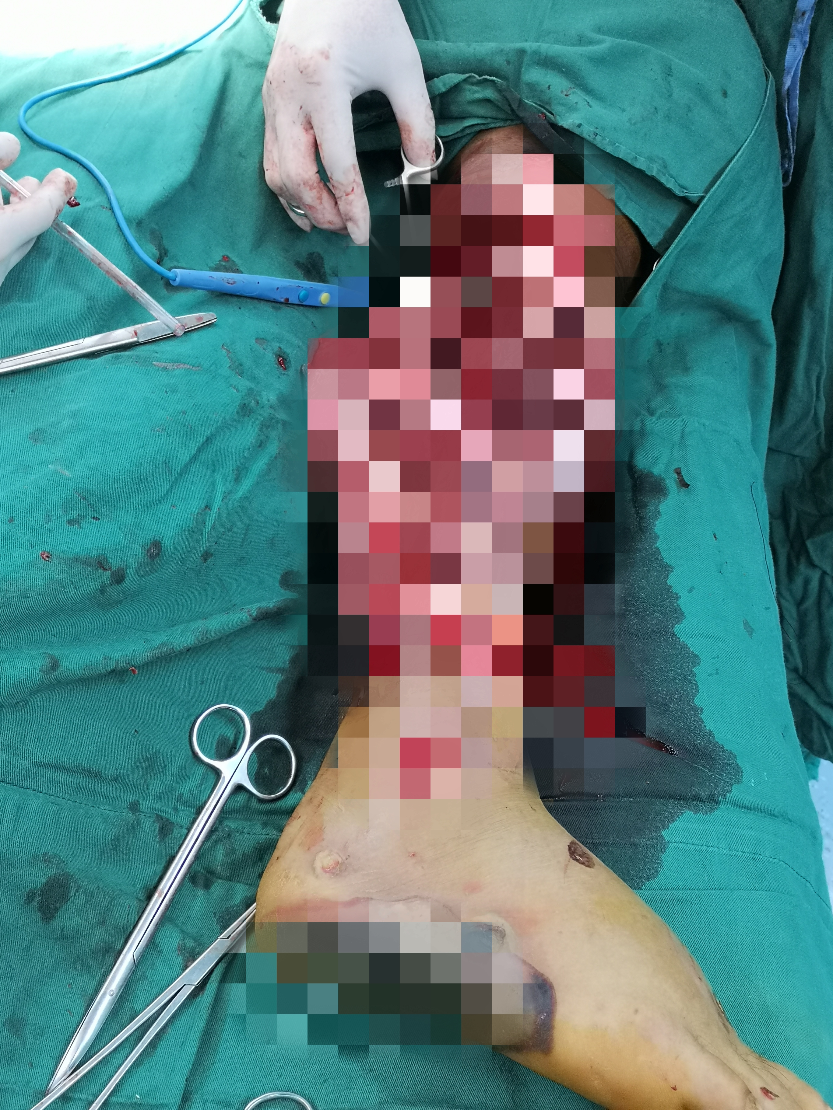 他站起来了改写一段话,他站了起来