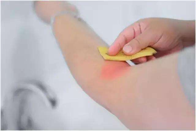 香蕉皮的神奇妙用,香蕉皮的神奇妙用你知道吗