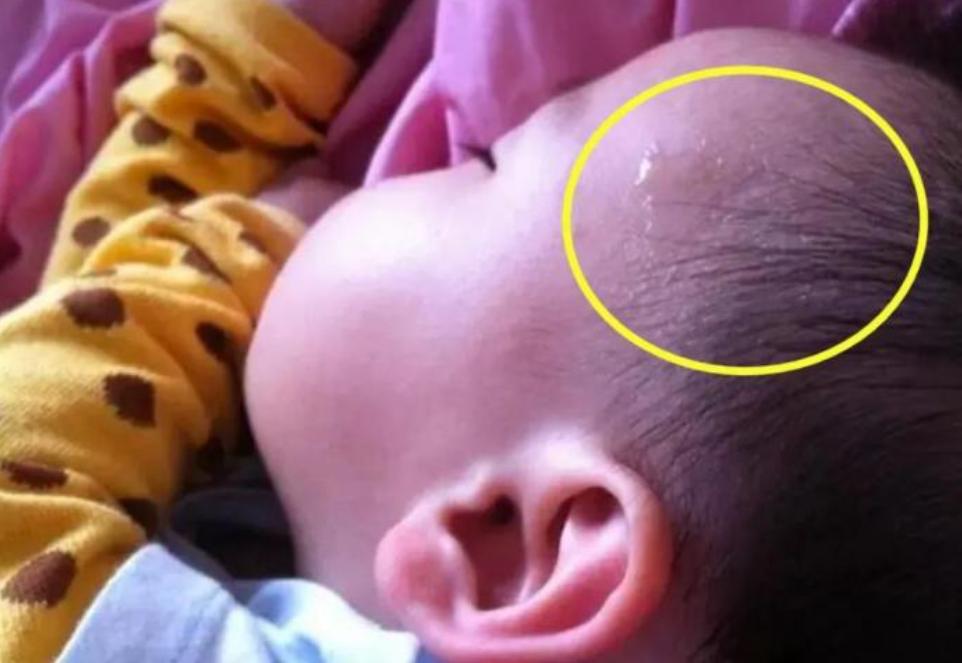 孩子一睡着就满头大汗是缺钙吗,婴儿睡着一头大汗是缺钙吗