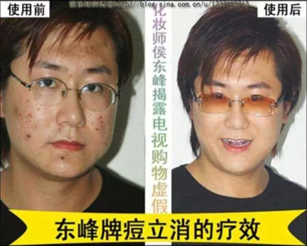 撕开“神医”的假面！虚假广告是怎么让你一步步上当的