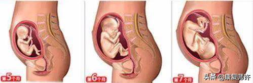 产后腹直肌分离的解决方法,产后腹直肌分离怎么处理