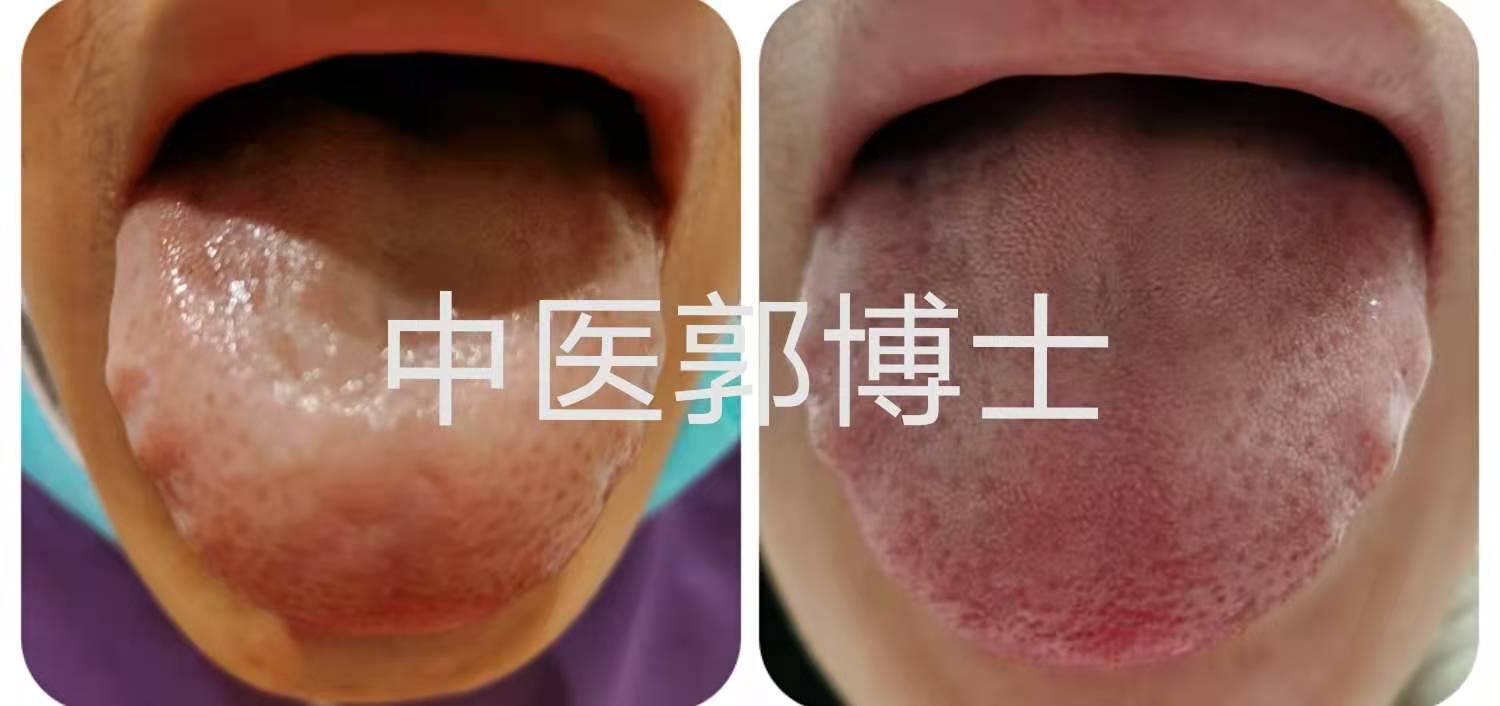 例假推迟轻微出血,例假推迟因为血不够