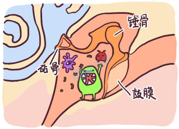 一岁宝宝中耳炎是什么导致的,一岁宝宝得中耳炎要怎么治疗