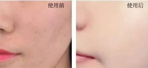 珍珠粉美白淡斑提亮肤色,淡化斑点美白提亮肤色