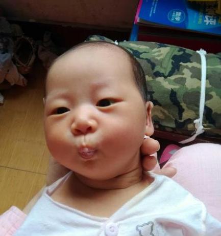 宝宝牙龈变形突出怎么恢复,宝宝上牙床凹凸不平怎么办