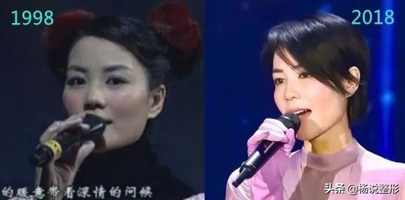 隆鼻整容老了会怎么样,隆鼻后老了