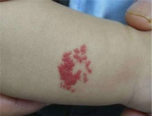 新生宝宝最常见的问题,新生宝宝必须注意的八件事