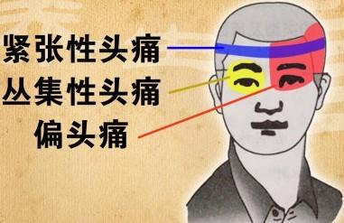 为什么头痛一会左边一会右边,为什么头痛总是左边