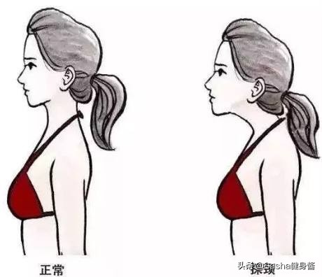 脖颈前伸腰背痛，都是探颈惹的祸，睡前做两个动作，改善探颈问题