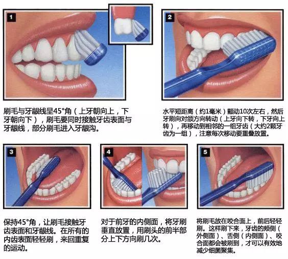 吃东西老塞牙，牙缝里有臭味！怎么办？