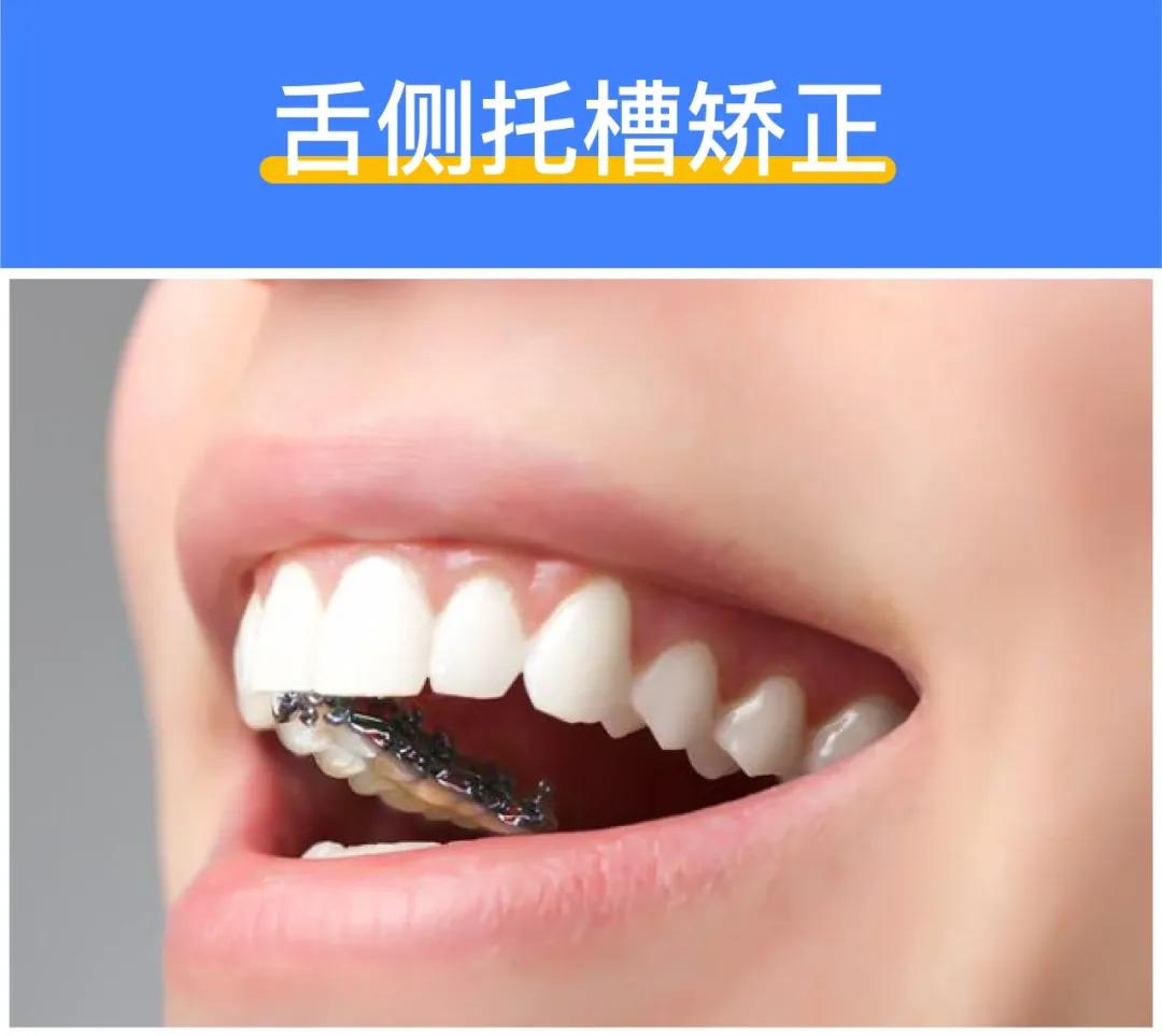 揭秘矫正牙齿多少钱,牙齿矫正全过程价格