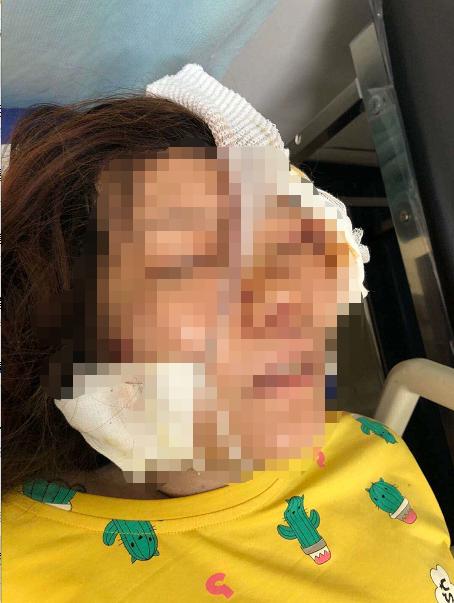 河北施工电梯事故,河北衡水电梯事故处理