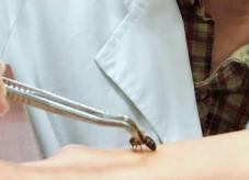 过敏性鼻炎春季高发期几月,春季是不是鼻炎高发期