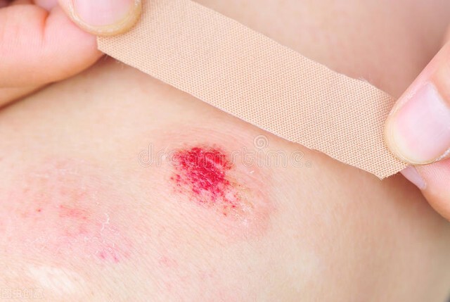 村里人说这个痣非“凶”即“淫”，吓得妈妈赶紧带孩子去点痣